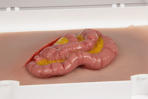 Moulage protruzie intestin subțire