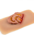 Moulage intestin subțire ieșit