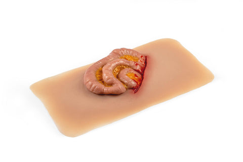 Moulage intestin subțire ieșit