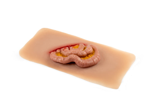 Moulage protruzie intestin subțire