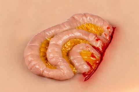 Moulage protruzie intestin subțire