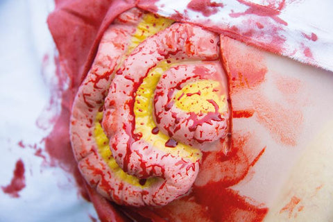 Moulage intestin subțire ieșit