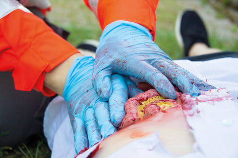 Moulage protruzie intestin subțire