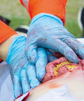 Moulage intestin subțire ieșit