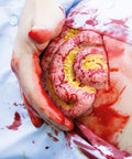 Moulage intestin subțire ieșit