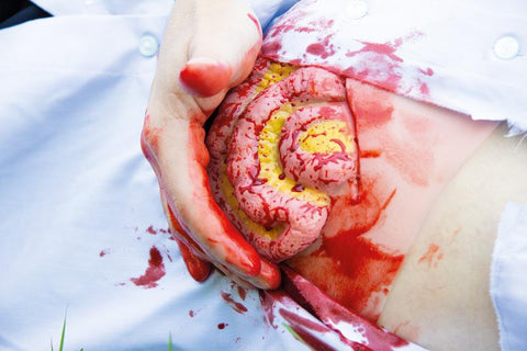 Moulage intestin subțire ieșit