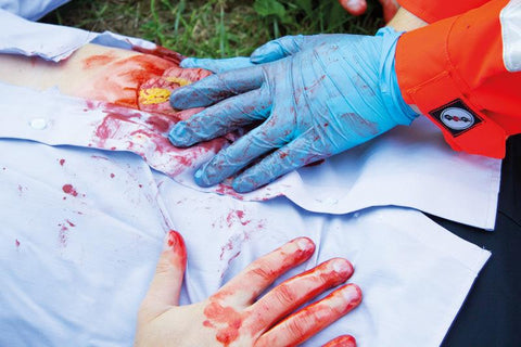 Moulage intestin subțire ieșit