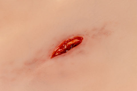 Moulage rană din înjunghiere cu funcție de sângerare