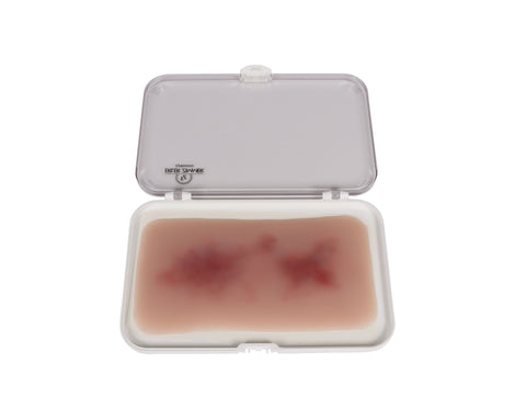 Wound moulage hematoma fresh