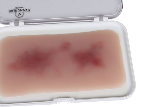 Wound moulage hematoma fresh