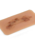 Moulage hematom proaspăt