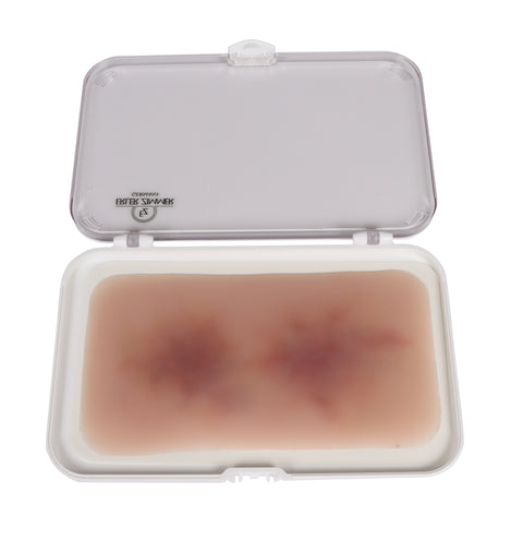 Wound moulage Hematoma older