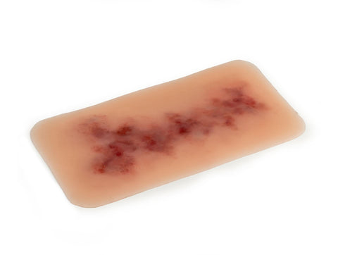 Moulage hematom mai vechi