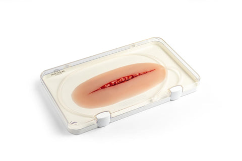 Moulage încercare de sinucidere