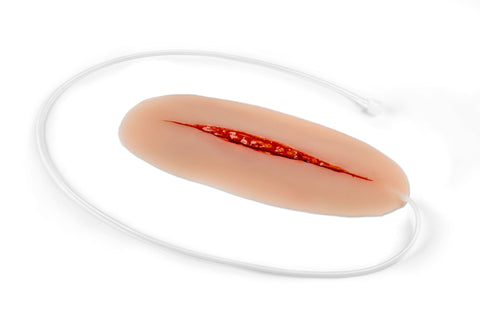 Moulage încercare de sinucidere
