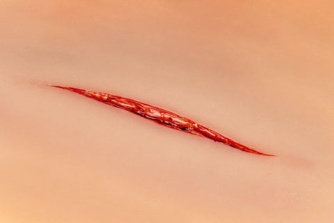 Moulage tăiătură pe gât
