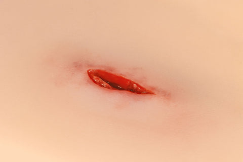 Moulage rană din înjunghiere pe gât