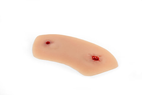 Moulage rană din armă de foc la articulația gleznei