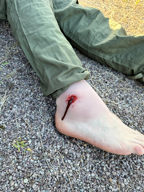 Moulage rană din armă de foc la articulația gleznei