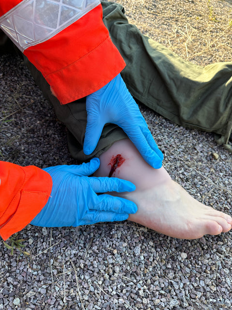 Moulage rană din armă de foc la articulația gleznei