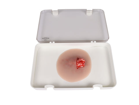 Wound presentation open fracture ankle joint