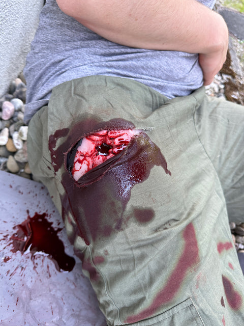 Moulage rană din armă de foc în regiunea inghinală, ambalare rană