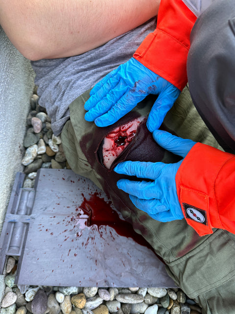 Moulage rană din armă de foc în regiunea inghinală, ambalare rană