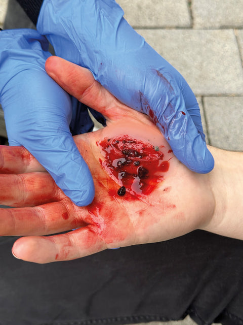 Moulage răni - Set standard