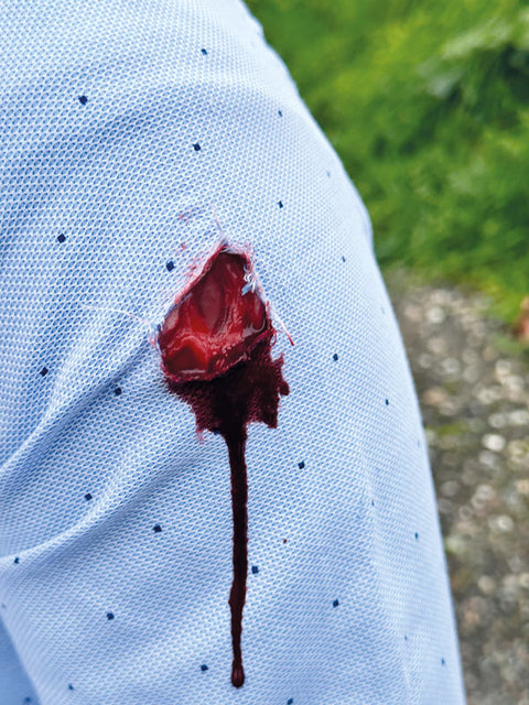 Moulage răni - Set standard