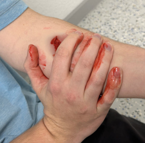 Moulage răni - Set standard