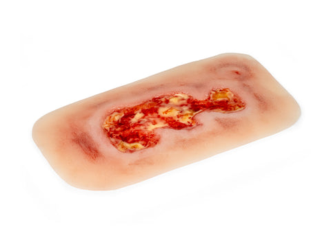 Rană simulator ulcer venos la picior, mic, faza de exudare
