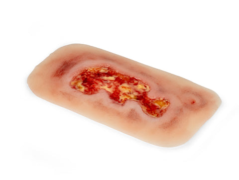 Rană simulator ulcer venos la picior, mic, faza de exudare