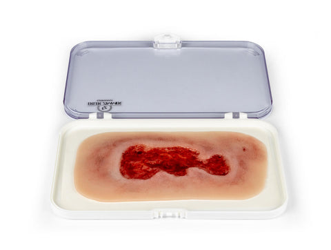 Rană simulator ulcer venous la picior, mic, faza de granulație