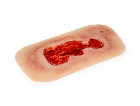Rană simulator ulcer venos la picior, mic, faza de granulație
