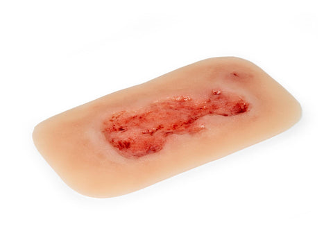 Rană simulator ulcer venos la picior, mic, faza de epitelizare