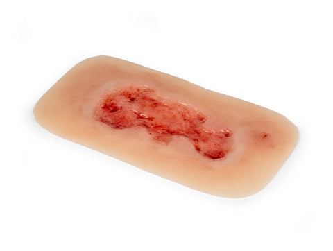 Rană simulator ulcer venos la picior, mic, faza de epitelizare