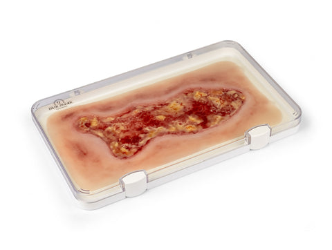 Rană simulator ulcer venos la picior, mare, faza de exudare