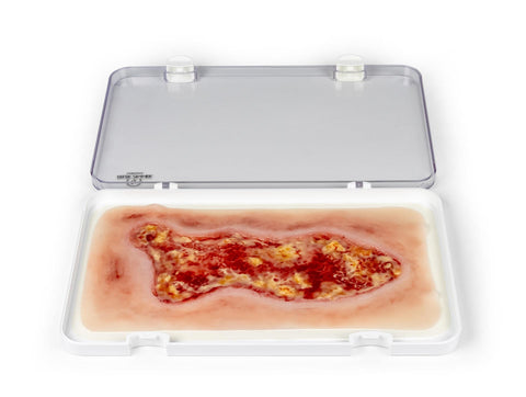 Rană simulator ulcer venous la picior, mare, faza de exudare