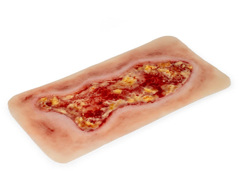Rană simulator ulcer venous la picior, mare, faza de exudare