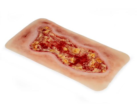 Rană simulator ulcer venos la picior, mare, faza de exudare