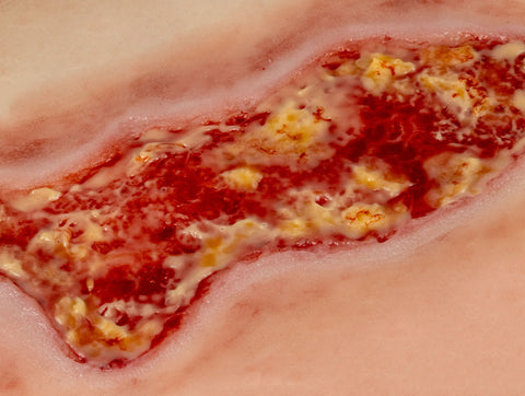 Rană simulator ulcer venos la picior, mare, faza de exudare