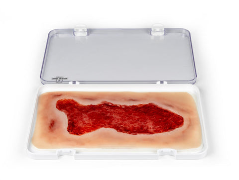 Rană simulator ulcer venos la picior, mare, faza de granulație