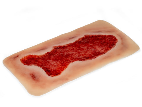 Rană simulator ulcer venos la picior, mare, faza de granulație