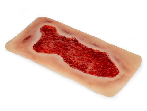 Rană simulator ulcer venos la picior, mare, faza de granulație