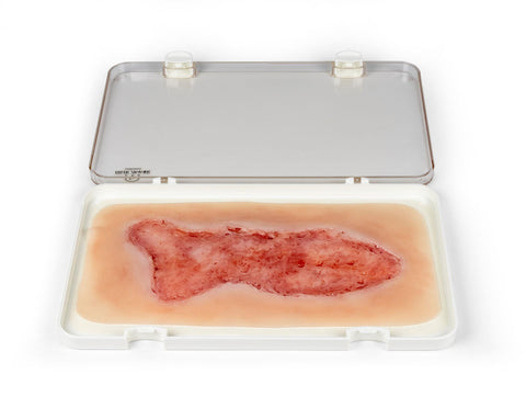 Rană simulator ulcer venous la picior, mare, faza de epitelizare