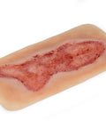 Rană simulator ulcer venous la picior, mare, faza de epitelizare