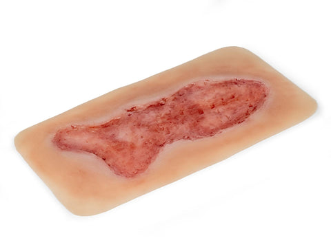 Rană simulator ulcer venous la picior, mare, faza de epitelizare