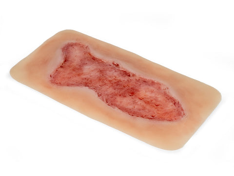 Rană simulator ulcer venos la picior, mare, faza de epitelizare