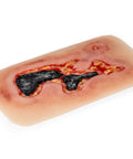 Rană simulator ulcer arterial la picior, mic, faza de exudare