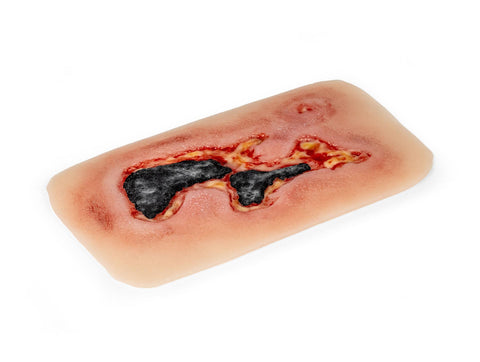 Rană simulator ulcer arterial la picior, mic, faza de exudare